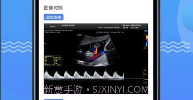 超声智库v1.2.31截图