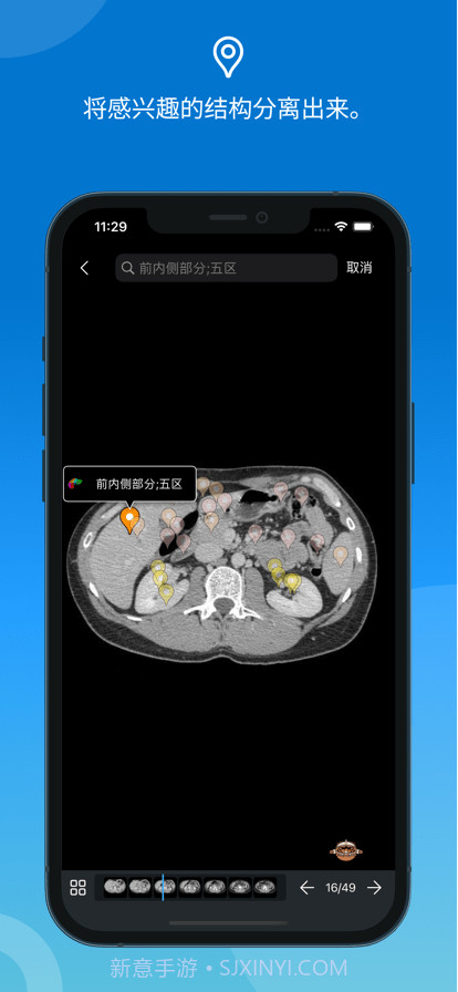 e-anatomy截图3 e-anatomy截图3