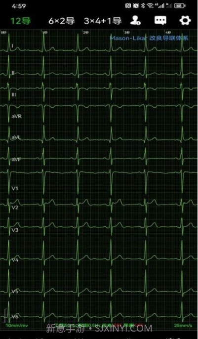 心电一张网截图4
