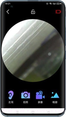 可视采耳仪截图3