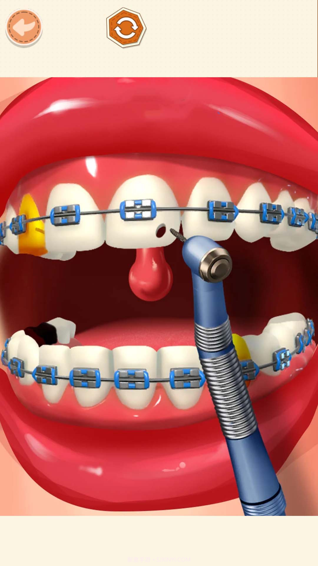 高级医生模拟截图4 高级医生模拟截图4