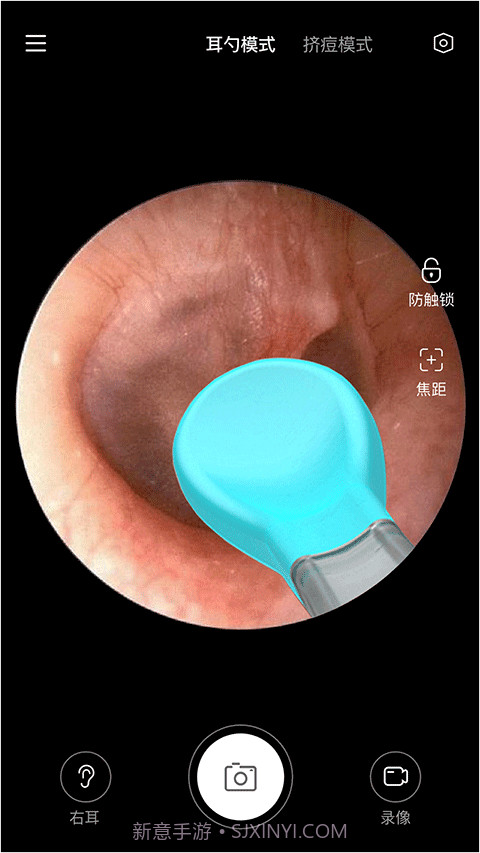 Xlife掏耳勺截图3 Xlife掏耳勺截图3