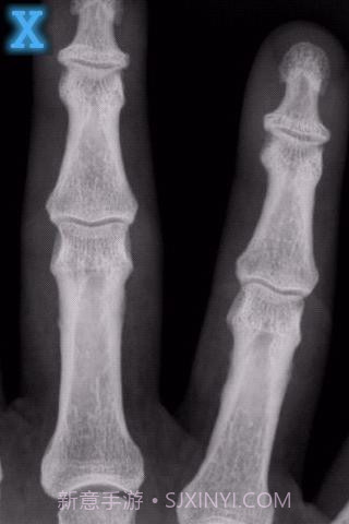 x光扫描器截图1