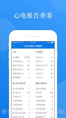 AI ECG截图4 AI ECG截图4