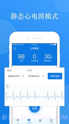 AI ECG截图2 AI ECG截图2