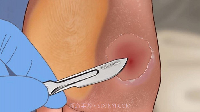 修脚足疔模拟器高画质版截图3 修脚足疔模拟器高画质版截图3