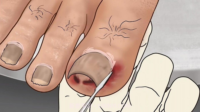 修脚足疔模拟器先行服截图1 修脚足疔模拟器先行服截图1